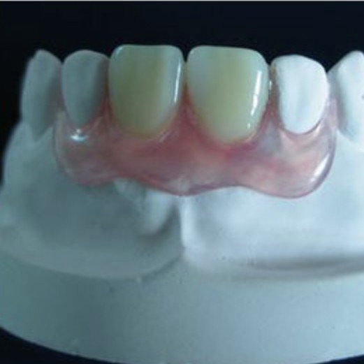 Anterior Teeth Nesbit Valplast
