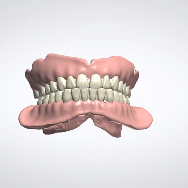 Dental Digital Acrylic Denture Design